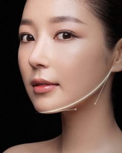 Gọt cằm v line bao nhiêu tiền? Cập nhật bảng giá gọt cằm mới nhất