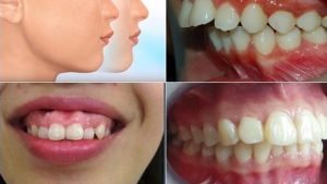Phẫu thuật hàm giá bao nhiêu? Địa chỉ phẫu thuật ở đâu tốt nhất? 