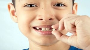 Nhổ răng vứt lên mái nhà có ý nghĩa gì?