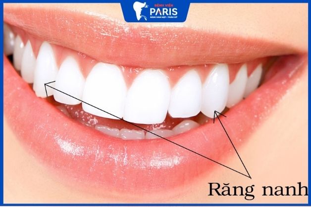 Răng nanh trong cung hàm