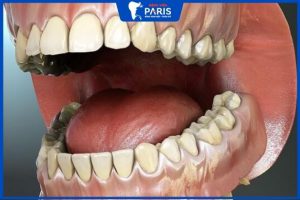 1 Hàm răng có bao nhiêu cái? Sơ đồ hàm răng của người