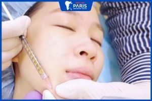 Độn cằm bằng mỡ tự thân – Sau 30 phút sở hữu cằm V-line tỷ lệ vàng