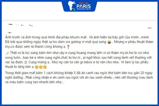 Chị Vy Nguyễn chia sẻ ăn nhiều rau xanh sau khi gọt mặt