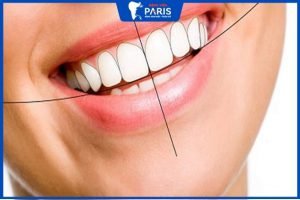5 Bí kíp cười hở 8 cái răng – Nụ cười thân thiện