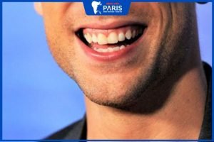 Đàn ông cười hở lợi giàu hay nghèo? 4 Cách chữa dứt điểm