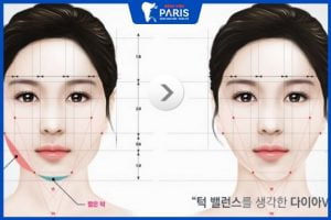 Gọt mặt có biến chứng không? Gọt mặt hỏng, méo, lệch do đâu?