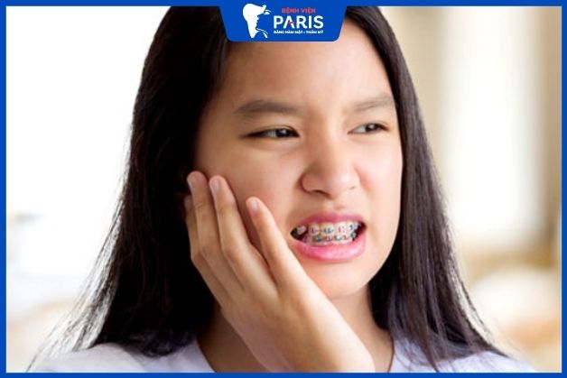 Niềng răng bằng mắc cài kim loại có thể gây đau nhức nhẹ