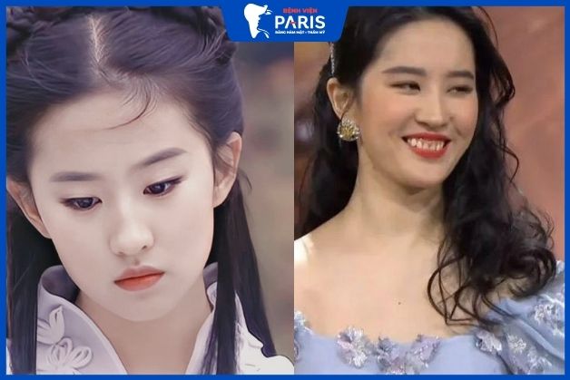 "Thần tiên tỉ tỉ" Lưu Diệc Phi nổi tiếng với nụ cười kém tươi tắn dù có nhan sắc "tiên nữ"