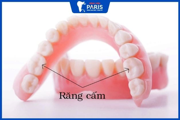 Răng số 6 có kích thước lớn nhất trên cung hàm