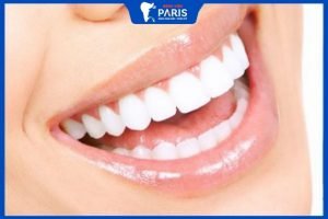 Thời gian gắn răng sứ bao lâu? 4 Cách gia tăng tuổi thọ răng sứ