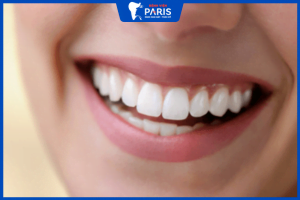 Trồng răng cửa là gì? Có mấy phương pháp trồng răng cửa?