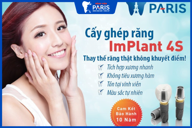  Trồng răng số 7 bằng công nghệ trồng răng Implant 4s