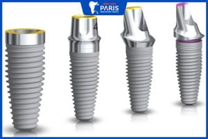 5 Loại trụ Implant tốt nhất trên thị trường -Bệnh viện RHM áp dụng