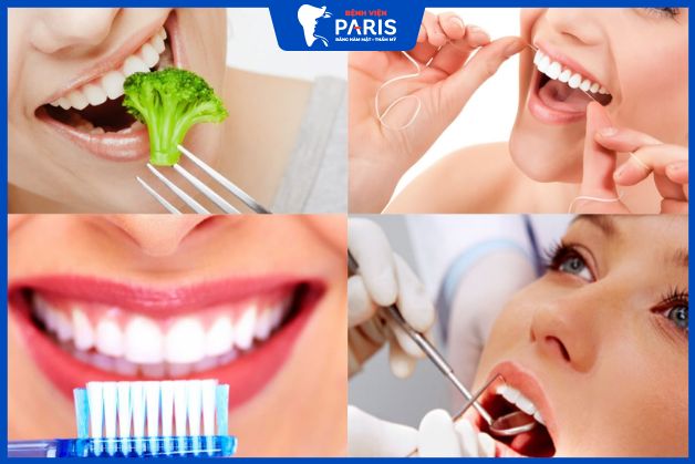 Cách chăm sóc răng Veneer được lâu
