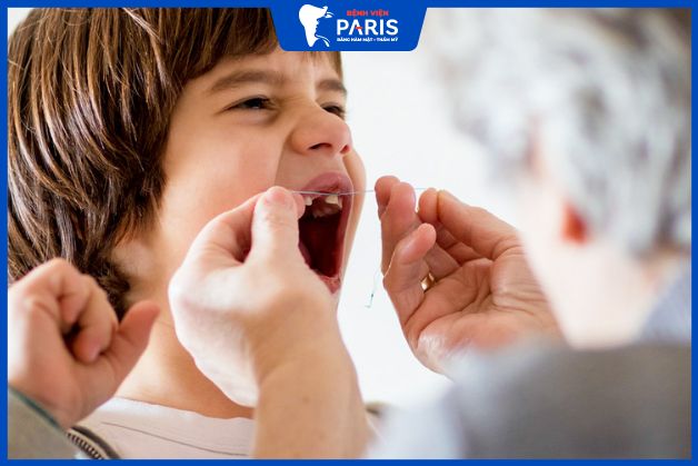 Cách nhổ răng sữa đúng cách, an toàn cho bé tại nhà