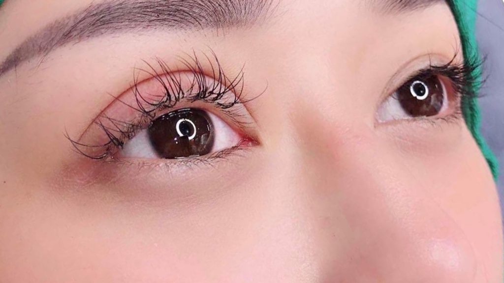 Cắt mí mắt giá bao nhiêu tiền? – 6 Lưu ý khi chăm sóc sau khi cắt mí