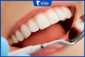 Chế độ bảo hành răng sứ tại Bệnh viện Răng Hàm Mặt Thẩm Mỹ Paris