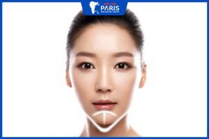 Độn cằm giá bao nhiêu? Bảng giá và địa chỉ thực hiện uy tín