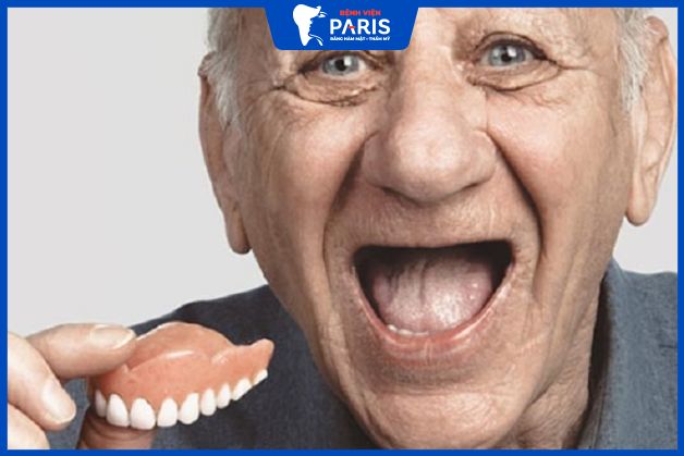 Hàm tháo lắp phù hợp với người cao tuổi bị mất nhiều răng