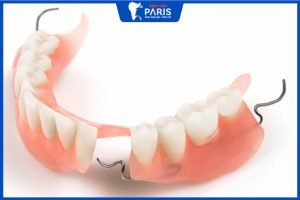 Hàm tháo lắp – 6 thông tin quan trọng mà bạn không thể bỏ qua