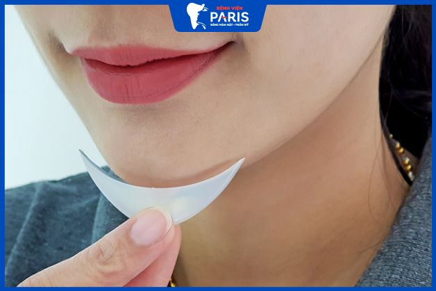 Một số câu hỏi về độn cằm