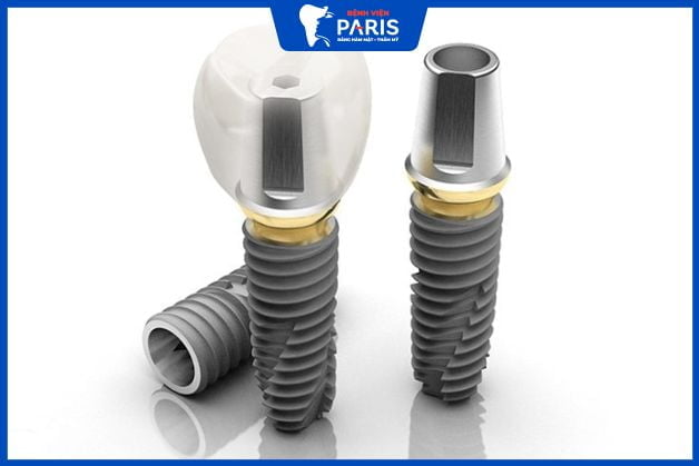 Trụ Implant được bảo hành dài hạn