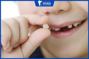 Nhổ răng sữa cho bé: Thời điểm nhổ răng tốt nhất, nhổ không đau
