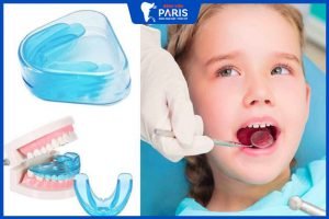 Niềng răng silicon: Lợi ích, phân loại và mức độ hiệu quả