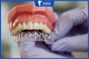 Niềng răng tháo lắp hiệu quả đến đâu? 7 Điều bạn cần hiểu rõ