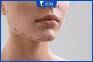 Phẫu thuật tạo hình hàm mặt uy tín – Bệnh viện Paris