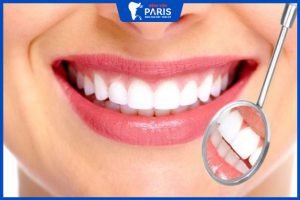 Răng sứ LISI có tốt không? phù hợp với những ai – Giá bao nhiêu
