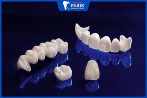 Răng sứ Zirconia – có tốt không – 7 điều cần biết