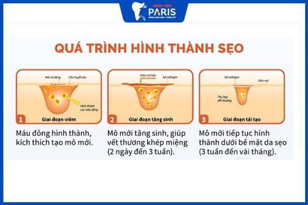 Sự hình thành của sẹo là như nào?