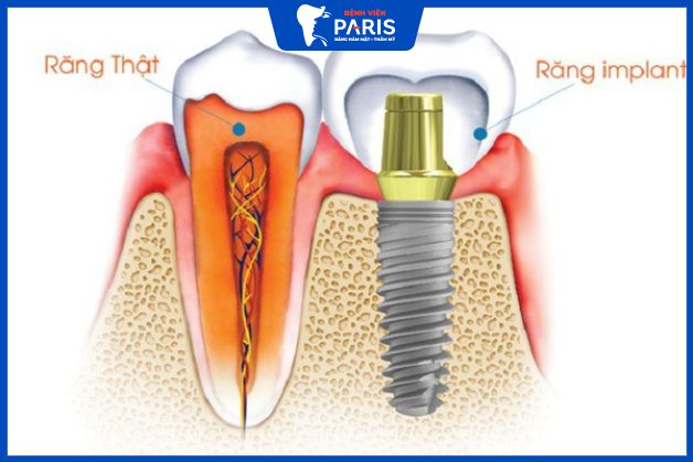 Tại sao ETK không dễ tiếp cận tại Việt Nam? 