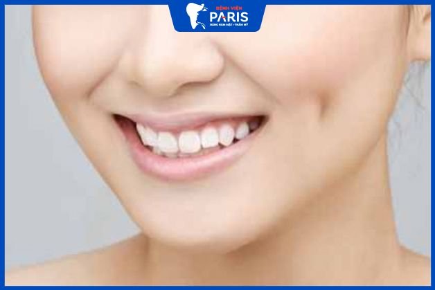 Hình ảnh khách hàng Nguyễn Thị Thu sau khi làm má lúm