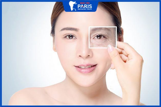 Không nên tiêm xóa nhăn khi mức độ lão hóa nặng