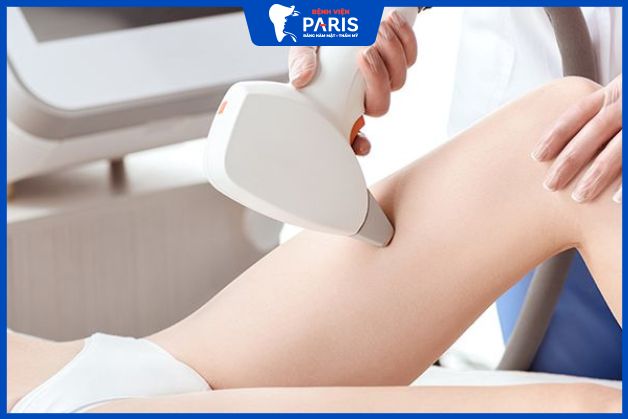 Diode laser được khách hàng ưa chuộng vì khắc phục được mọi nhược điểm của công nghệ cũ