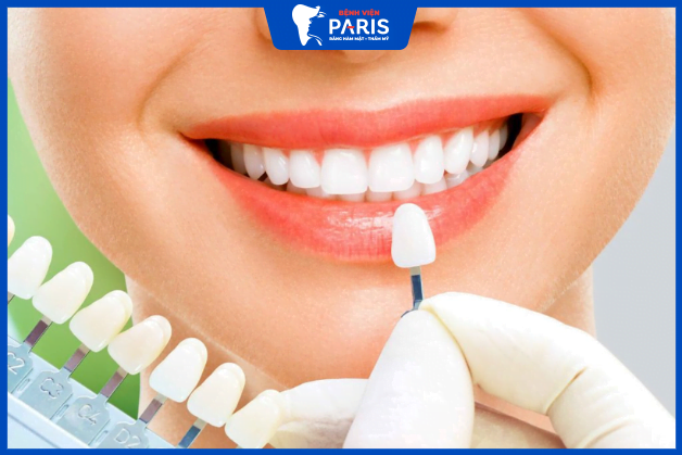 Trồng răng giả bao lâu hoàn thiện?