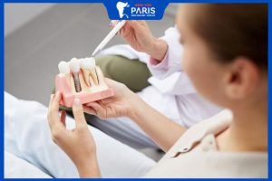 Trồng răng Implant bao nhiêu tiền một cái? 4 yếu tố quyết định đến giá
