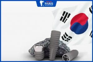 Trụ Implant Korea: Ưu nhược điểm và bảng giá MỚI