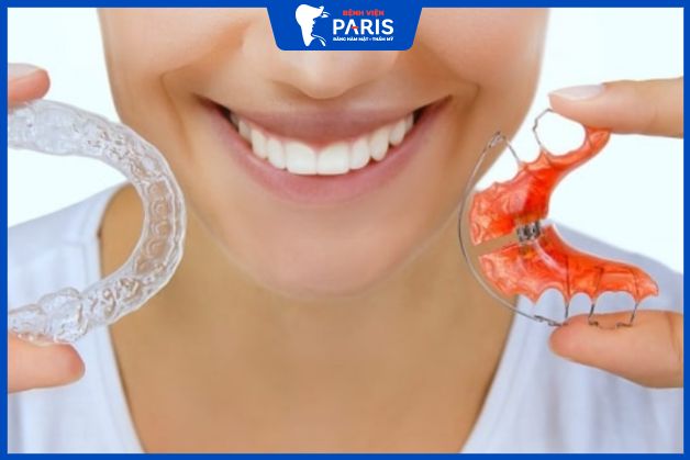 Vì sao gọi là niềng răng tháo lắp?