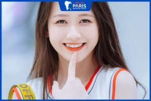 Có nên làm răng khuyển duyên không? Phương pháp thực hiện