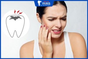 Làm gì để giảm đau răng? – 11 mẹo đơn giản, hiệu quả tức thì