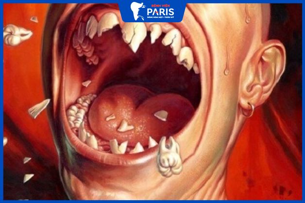 Nguyên nhân dẫn đến thiếu răng cửa hàm dưới