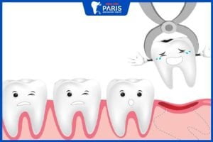 Nhổ răng hàm không trồng lại có sao không? 6 tác hại thường gặp