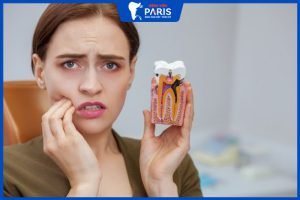 Viêm chân răng phải làm sao? Các cách điều trị dứt điểm