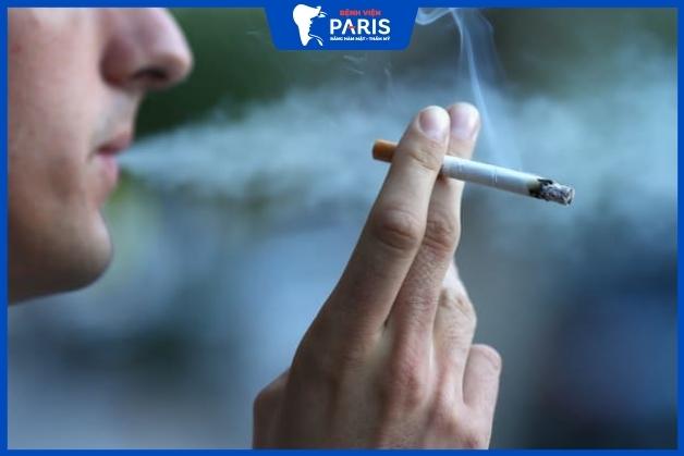 Hút thuốc lá làm tăng nguy cơ mắc bệnh viêm nướu