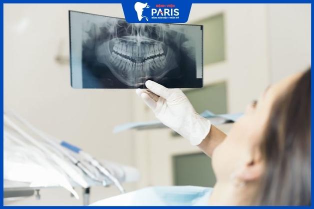 Thăm khám và chụp X - quang tình trạng răng miệng