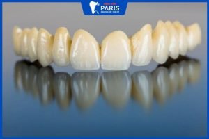 Độ bền của răng sứ Emax – Những điều bạn chưa biết về Emax