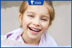 Tổng hợp 6 kinh nghiệm niềng răng cho trẻ mà cha mẹ cần biết